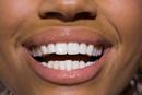 Trust Us for Your Dental Emergency in Toronto